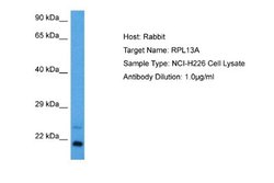 RPL13A Antibody, Novus Biologicals 100 &mu;L; Unconjugated:Antibodies,